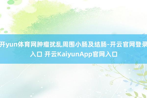 开yun体育网肿瘤扰乱周围小肠及结肠-开云官网登录入口 开云KaiyunApp官网入口